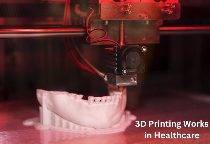 3D Printing in Healthcare