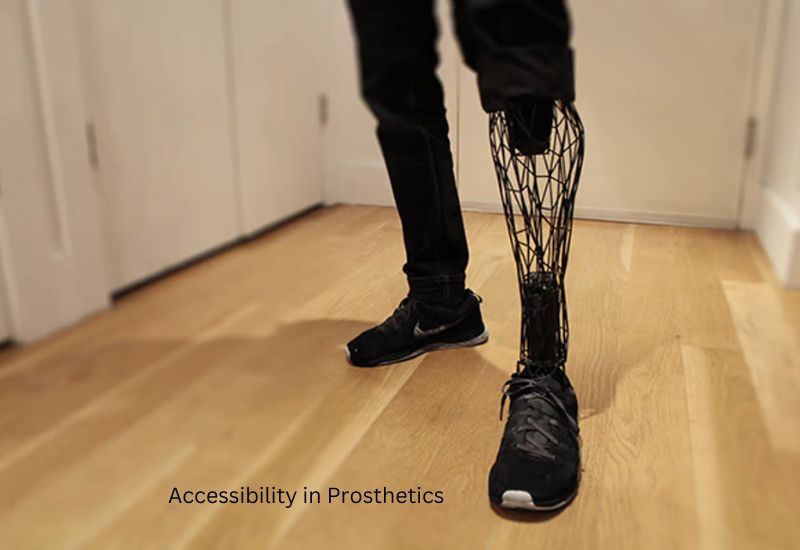 3d printing in prosthetics