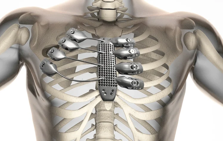 3D Printed Medical Devices